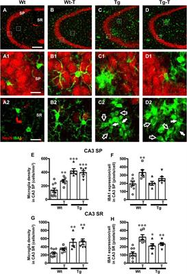 Chronic administration of prebiotics and probiotics ameliorates pathophysiological hallmarks of Alzheimer’s disease in a APP/PS1 transgenic mouse model